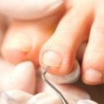 Podologie: professionelle Fußbehandlung