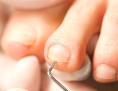 Podologie: professionelle Fußbehandlung